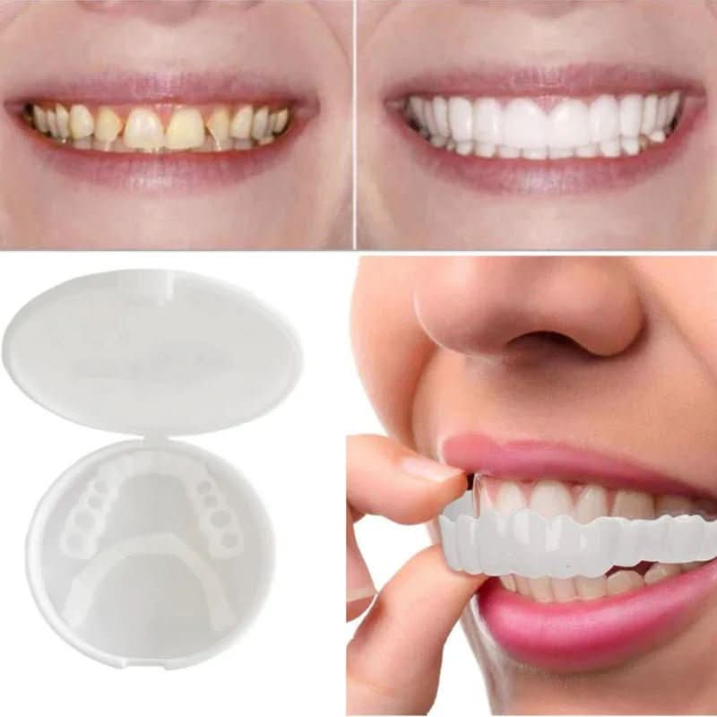 Snap-On Tooth Cover, Heat-Moldable and Reusable