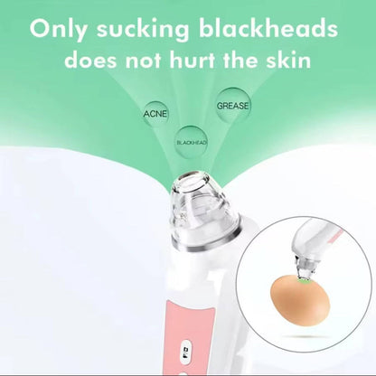 Blackhead Remover Vacuum with Camera