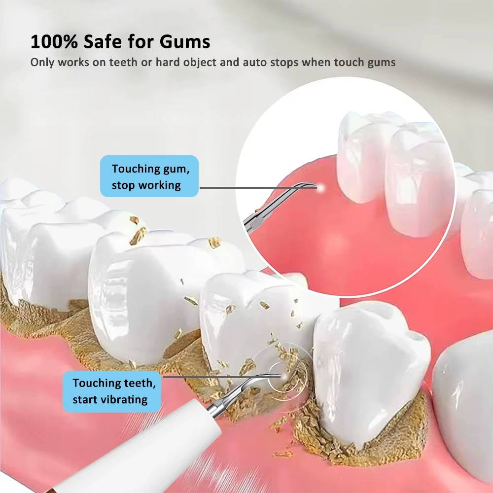 Electric Dental Calculus & Tartar Remover