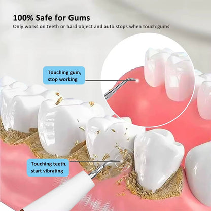 Electric Dental Calculus & Tartar Remover