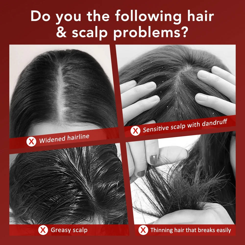Scalp Stimulating Massage Brush