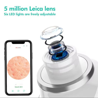 Blackhead Remover Vacuum with Camera