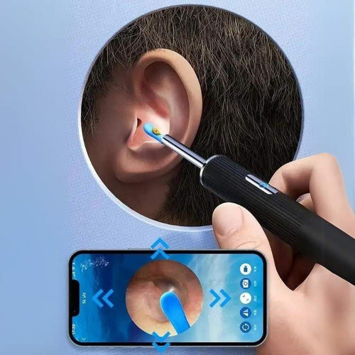 Ear Wax Removal Camera with LED