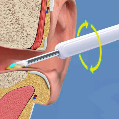 Ear Wax Removal Camera with LED