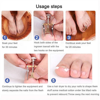 Stainless Steel Toenail Clip Tool, 2 Piece