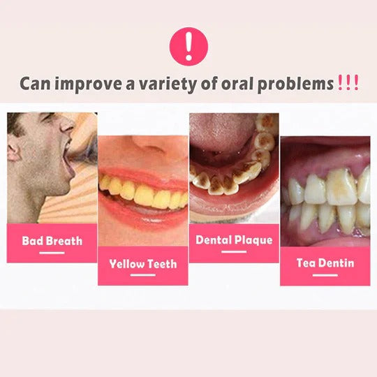 Electric Dental Plaque Cleaner
