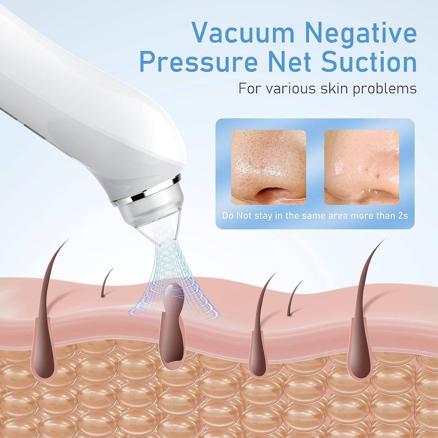 Blackhead Remover Vacuum with Camera