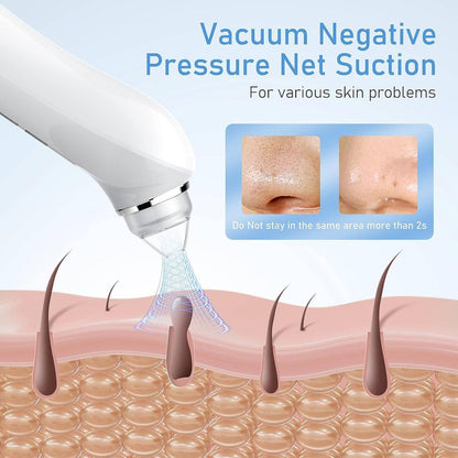 Blackhead Remover Vacuum with Camera